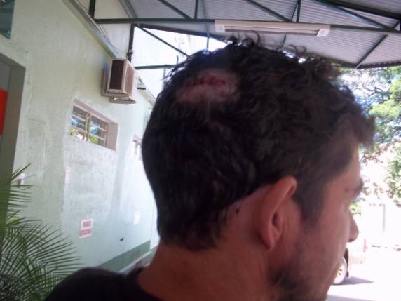 A brigada ocorreu na casa onde moram 

os dois irmãos
