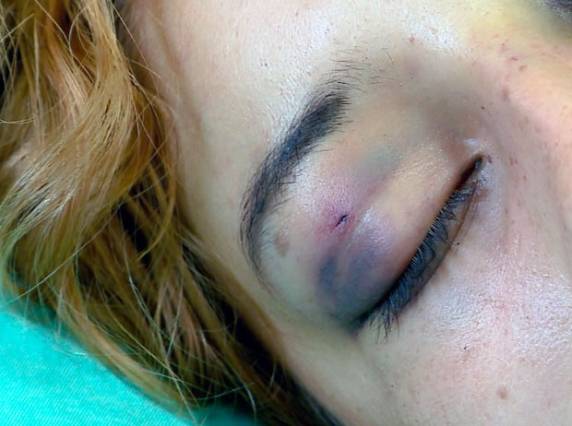 Apenado tenta matar sua esposa com golpe de faca