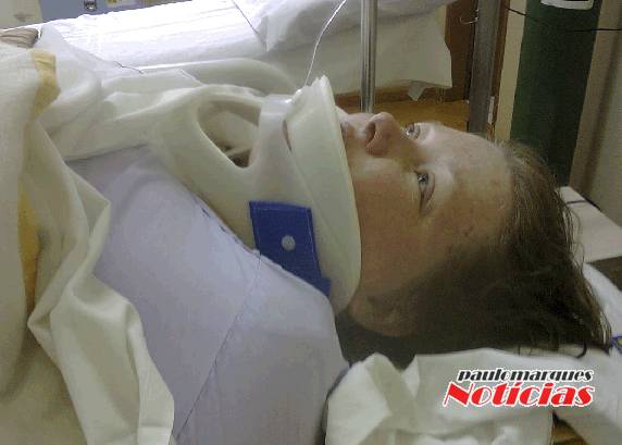 Fratura na perna direita e escoriações pelo corpo, foram resultantes de um atropelamento em frente ao Mercado Cotrimaio