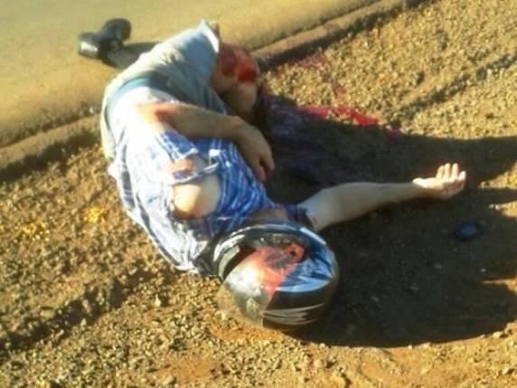 Homem perde parte da perna, e empresário diz que a moto foi furtada de sua revenda de veículos