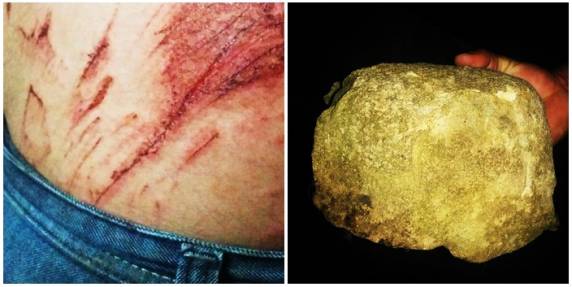 Atendimento só para o bandido Vítima teve que voltar para casa sem nenhum band-aid