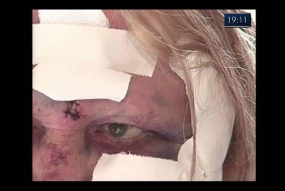 Rapaz de 19 

anos deu facadas e golpes com botijão em idosa de 76 anos