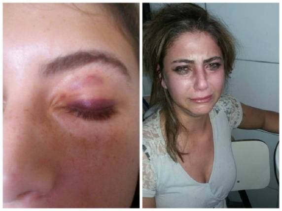 Luciana Fernandes, 23 anos, foi espancada 

dentro da escola em que trabalha