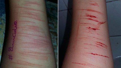 Menina de 

apenas 12 anos foi encontrada com os braços automutilados e com a escrita 