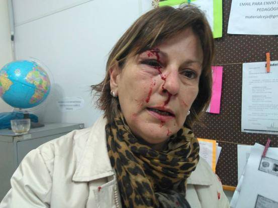 Educadora compartilhou fotos e o relato da agressão em rede social