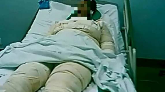 Ela segue internada em estado grave em Caxias do Sul. Bebê de oito meses estava no seu colo e também foi ferido
